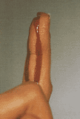 Schnittwunde Finger